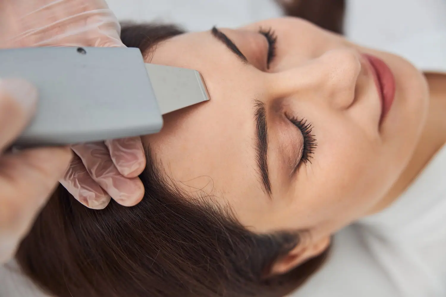Dermaplaning - wszystko co musisz wiedzieć